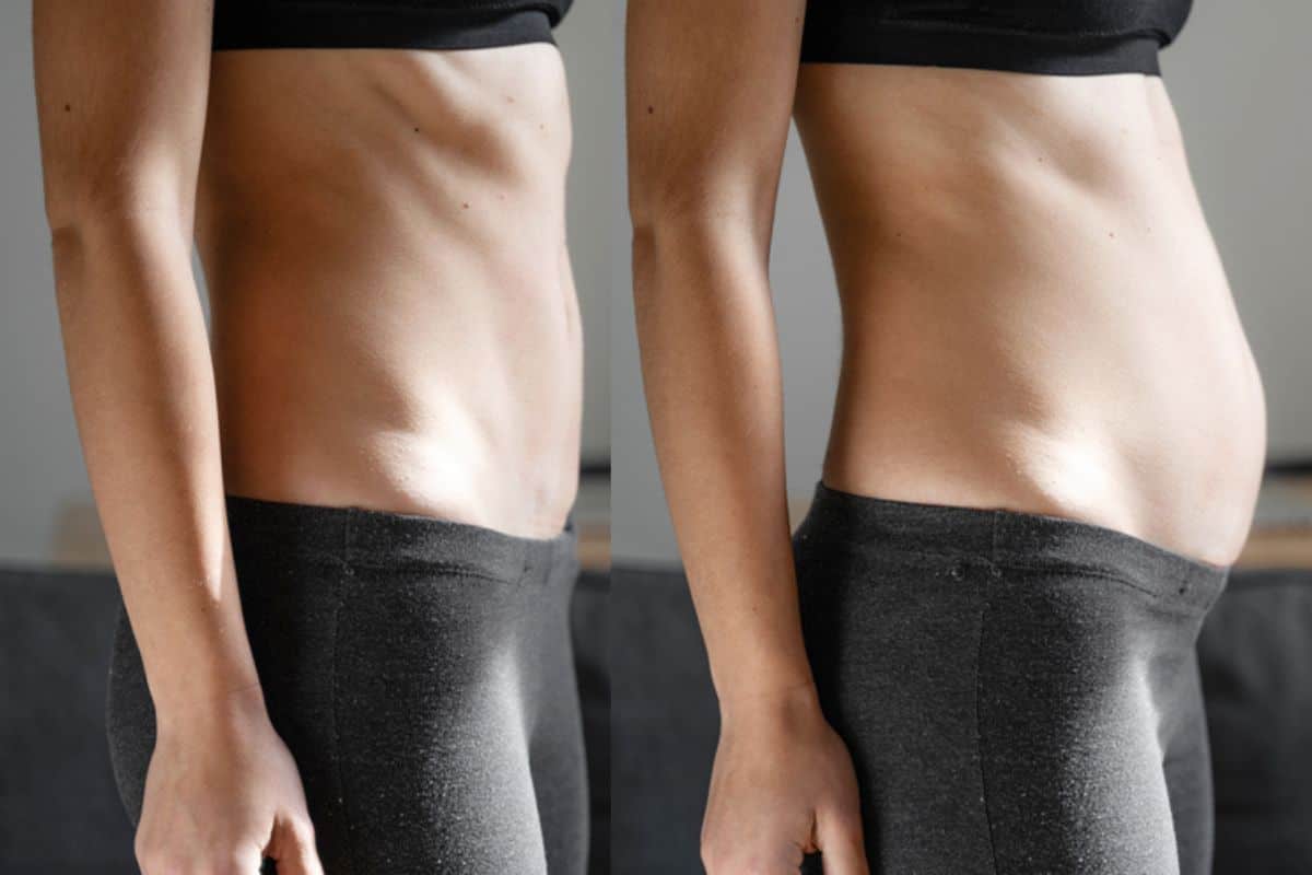 How long does diastasis recti take to improve Southall?