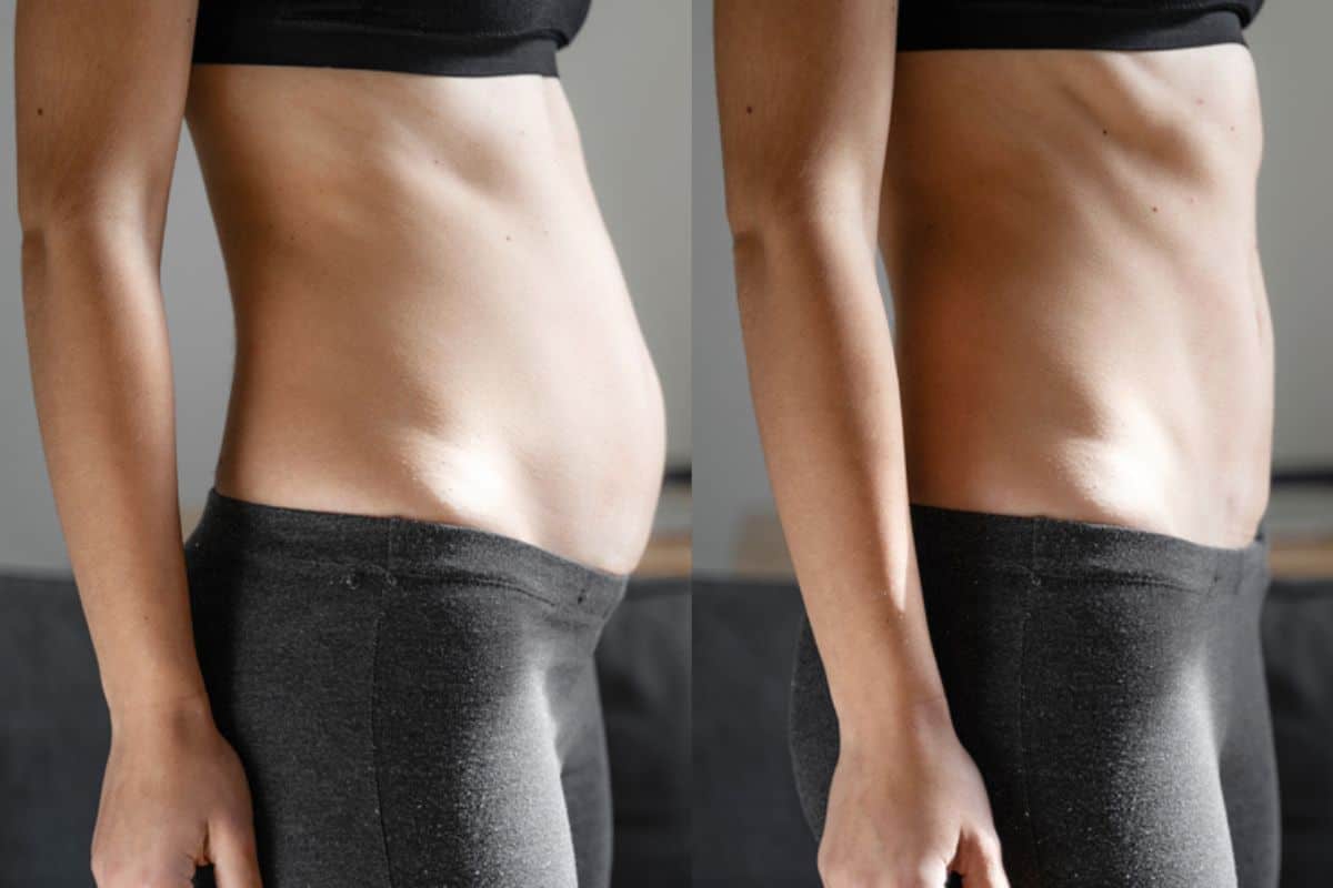 Post-Pregnancy: What Happens to Your Abdominal Muscles After Birth Southall