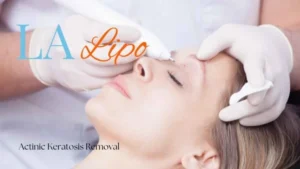 Woman receiving Actinic Keratosis Removal Treatment Southall