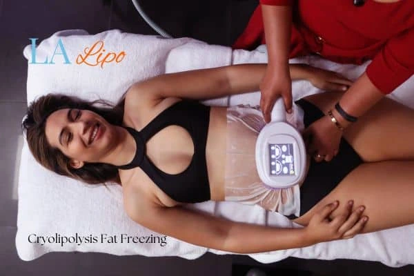woman getting cryolipolysis Southall