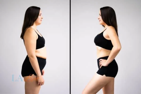 link between body image and mental health Southall