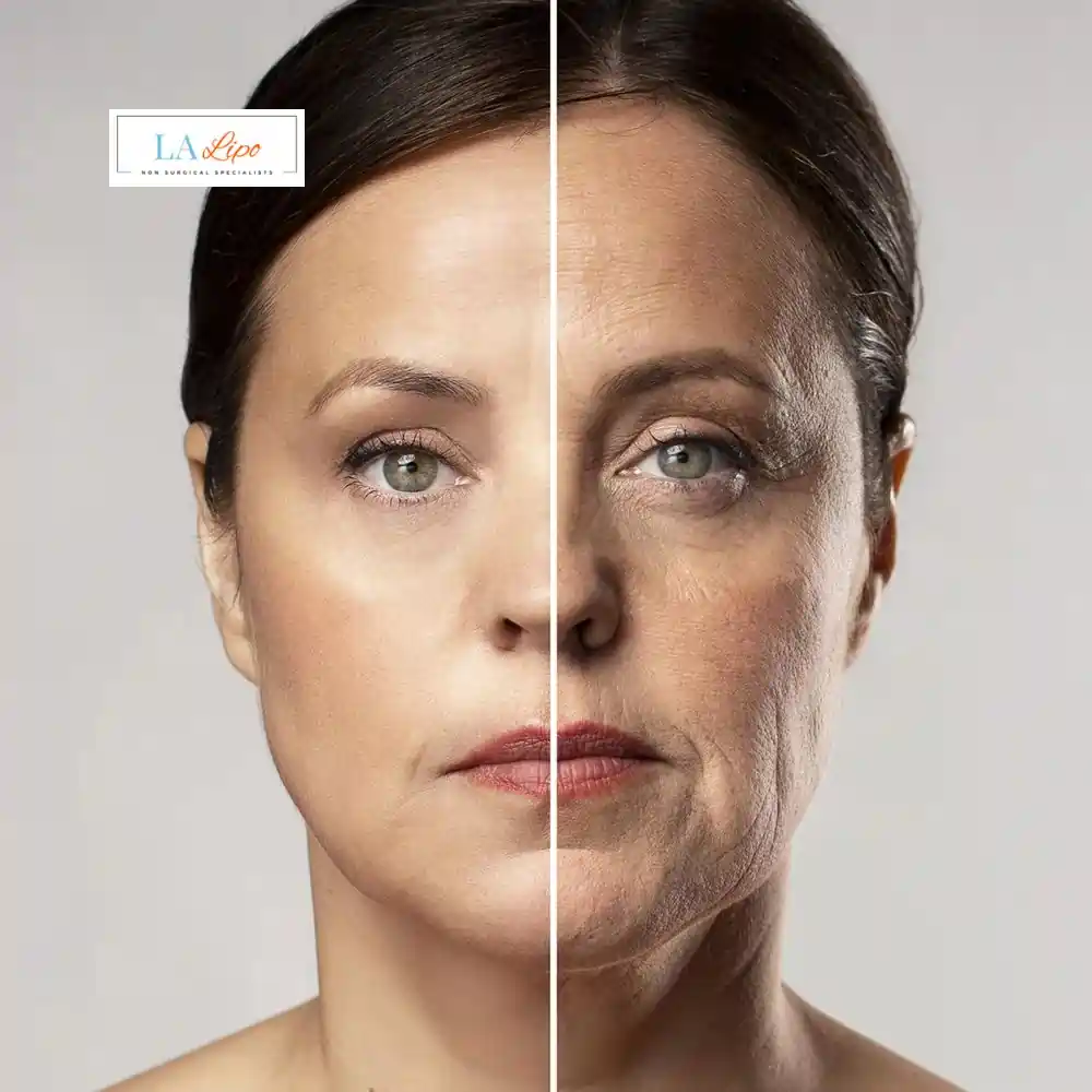 How Can You Tell If Non-Surgical Skin Tightening Is Right for You Southall?